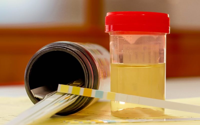 Best synthetic urine